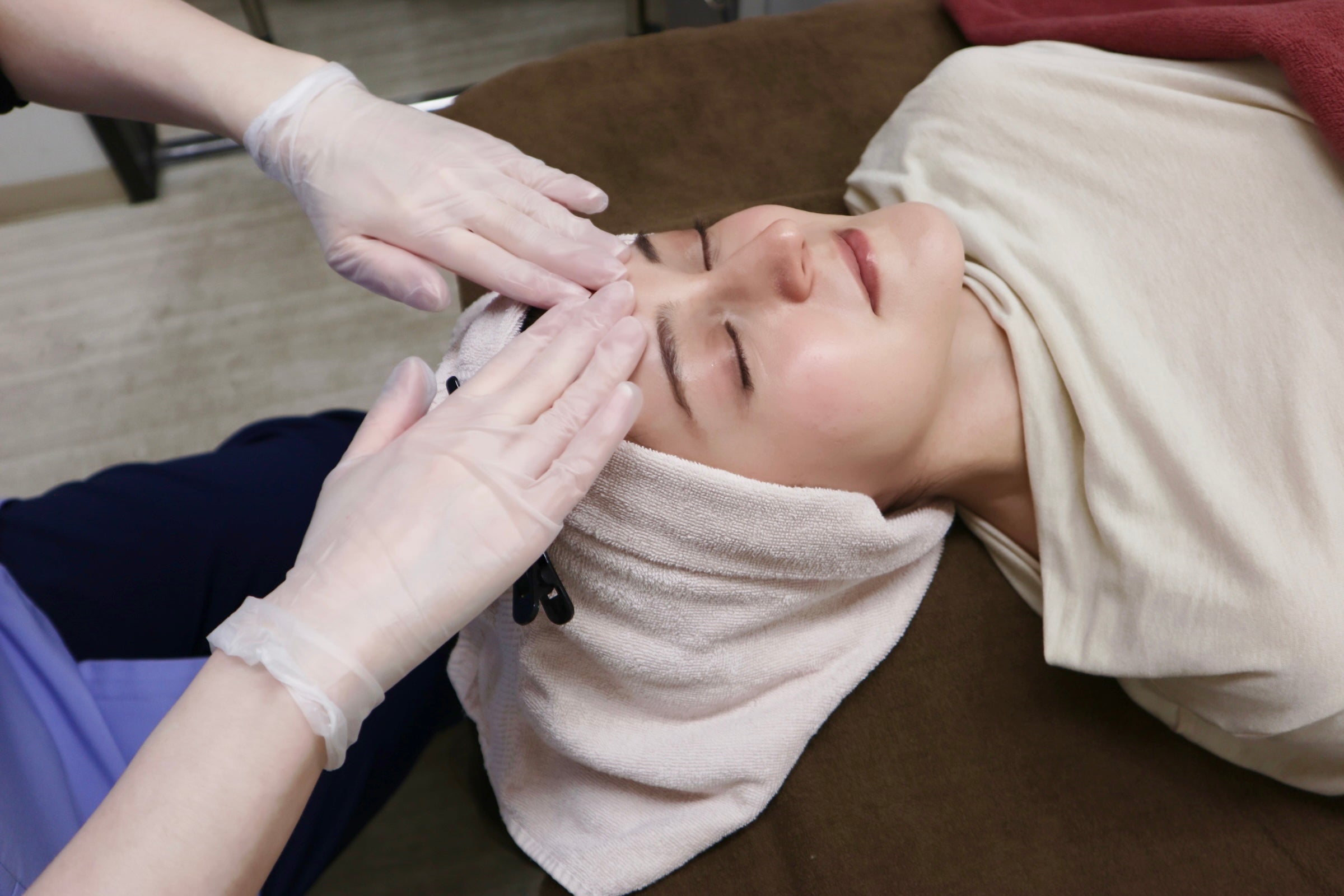 C : Chemical Exfoliation ＋ Intense Pulsed Light (135min)