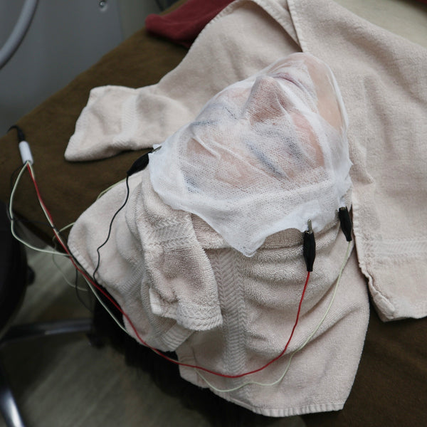 Vitamin Nourishment : Tranexamic acid (45min)