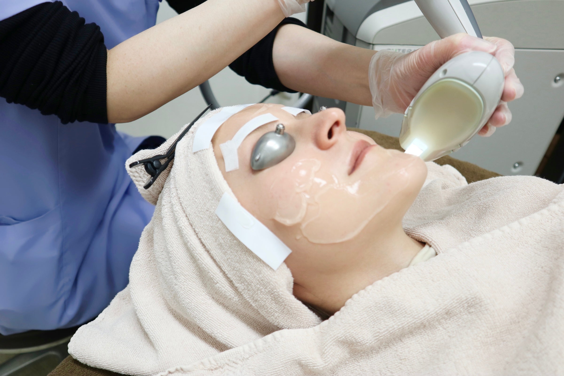 Laser Facelift (90min)